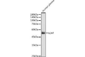 Western blot analysis of extracts of Human plasma, using LCAT antibody (ABIN6130520, ABIN6143108, ABIN6143110 and ABIN6215439) at 1:1000 dilution. (LCAT 抗体  (AA 25-440))