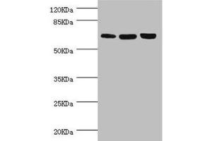Western blot All lanes: CTNNBL1 antibody at 5. (CTNNBL1 抗体  (AA 264-563))