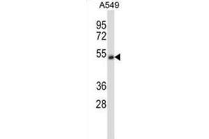 Western Blotting (WB) image for anti-Cholinergic Receptor, Nicotinic, alpha 5 (Neuronal) (CHRNA5) antibody (ABIN2997668) (CHRNA5 抗体)