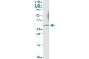 Immunoprecipitation of KHK transfected lysate using anti-KHK MaxPab rabbit polyclonal antibody and Protein A Magnetic Bead , and immunoblotted with KHK MaxPab mouse polyclonal antibody (B01) . (Ketohexokinase 抗体  (AA 1-298))