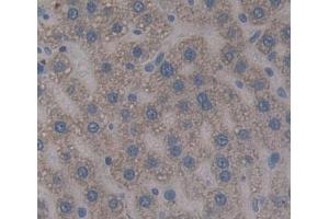 Used in DAB staining on fromalin fixed paraffin- embedded liver tissue (TOP1MT 抗体  (AA 1-238))