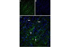 Immunohistochemistry (IHC) image for anti-Transient Receptor Potential Cation Channel, Subfamily C, Member 5 (TRPC5) (AA 959-973), (Intracellular) antibody (ABIN7043823)