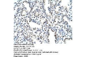 Rabbit Anti-WDR6 Antibody  Paraffin Embedded Tissue: Human Lung Cellular Data: Alveolar cells Antibody Concentration: 4. (WDR6 抗体  (C-Term))