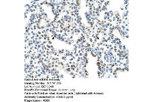 Rabbit Anti-WDR6 Antibody  Paraffin Embedded Tissue: Human Lung Cellular Data: Alveolar cells Antibody Concentration: 4. (WDR6 抗体  (C-Term))