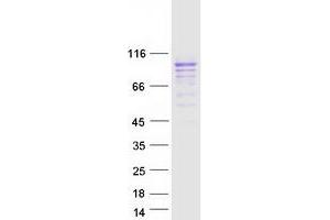 Validation with Western Blot (SLC3A2 Protein (Transcript Variant 3) (Myc-DYKDDDDK Tag))