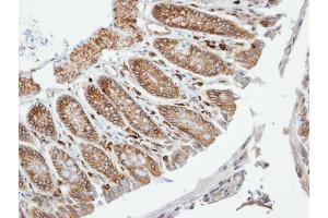 IHC-P Image Immunohistochemical analysis of paraffin-embedded human colon, using VAM1, antibody at 1:100 dilution.