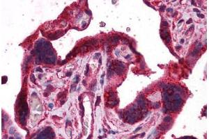 Human Placenta: Formalin-Fixed, Paraffin-Embedded (FFPE) (DPP8 抗体  (AA 1-39))