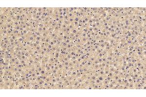 Immunohistochemistry (IHC) image for anti-Complement Fragment 3a (C3a) (AA 671-748) antibody (ABIN7439093)