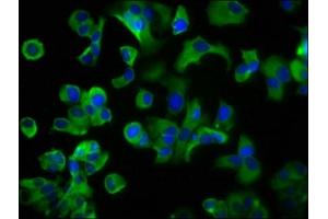 Immunofluorescence staining of MCF-7 cells with ABIN7158571 at 1:200, counter-stained with DAPI. (LRP2 抗体  (AA 202-332))