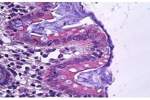 Human Colon, Epithelium: Formalin-Fixed, Paraffin-Embedded (FFPE) (SLC12A2 抗体  (AA 769-783))