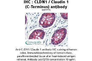 Image no. 1 for anti-Claudin 1 (CLDN1) (C-Term) antibody (ABIN2852381) (Claudin 1 抗体  (C-Term))