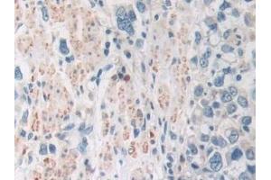 Immunohistochemistry (IHC) image for anti-Sirtuin 4 (SIRT4) (AA 28-314) antibody (ABIN7435928)