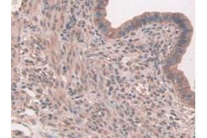 IHC-P analysis of Mouse Uterus Tissue, with DAB staining. (FAP 抗体  (AA 542-761))