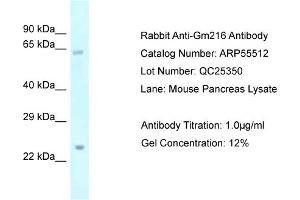 Western Blotting (WB) image for anti-Predicted Gene 216 (GM216) (Middle Region) antibody (ABIN2786243)