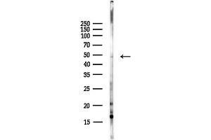 anti-Proteasome (Prosome, Macropain) 26S Subunit, ATPase, 3 (PSMC3) antibody