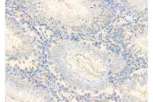 ABIN6261363 and ABIN6278853 at 1/100 staining Rat testis tissue by IHC-P. (CALY 抗体  (Internal Region))