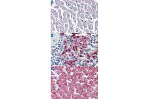 Immunohistochemistry (Formalin/PFA-fixed paraffin-embedded sections) of human heart (A), human spleen (B) and human liver tissue (C) tissue with CYSLTR2 polyclonal antibody . (CasLTR2 抗体  (N-Term))