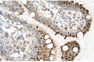 Human Intestine; Rabbit Anti-ZFP1 Antibody. (Zfp-1 抗体  (N-Term))