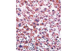 Immunohistochemistry (Paraffin-embedded Sections) (IHC (p)) image for anti-Cytochrome P450, Family 2, Subfamily C, Polypeptide 9 (CYP2C9) (AA 82-110), (N-Term) antibody (ABIN392355)