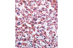 CYP2C9 Antibody (N-term) ((ABIN392355 and ABIN2841994))immunohistochemistry analysis in formalin fixed and paraffin embedded human liver tissue followed by peroxidase conjugation of the secondary antibody and DAB staining. (CYP2C9 抗体  (N-Term))