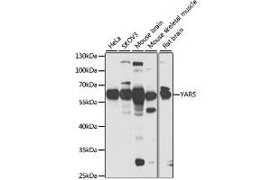Western blot analysis of extracts of various cell lines, using YARS antibody. (YARS 抗体)