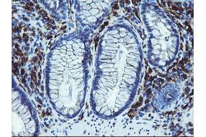 Immunohistochemical staining of paraffin-embedded Human colon tissue using anti-LRRC25 mouse monoclonal antibody. (LRRC25 抗体)