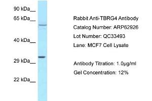 Western Blotting (WB) image for anti-Transforming Growth Factor beta Regulator 4 (TBRG4) (C-Term) antibody (ABIN2789300) (TBRG4 抗体  (C-Term))