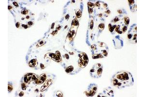Immunohistochemistry (IHC) image for anti-Solute Carrier Family 4, Anion Exchanger, Member 1 (erythrocyte Membrane Protein Band 3, Diego Blood Group) (SLC4A1) (AA 28-365) antibody (ABIN3043930)