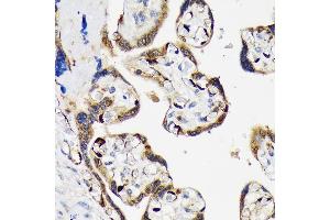 Immunohistochemistry of paraffin-embedded human placenta using LIN28B Rabbit mAb (ABIN7268267) at dilution of 1:100 (40x lens). (LIN28B 抗体)