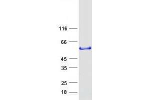 Western Blotting (WB) image for Sorting Nexin 16 (SNX16) (Transcript Variant 1) protein (Myc-DYKDDDDK Tag) (ABIN2732396)