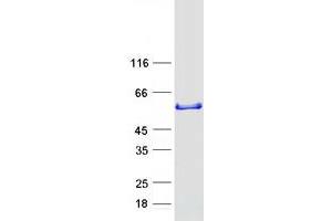 Validation with Western Blot (SNX16 Protein (Transcript Variant 1) (Myc-DYKDDDDK Tag))