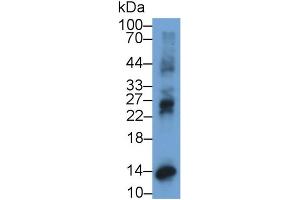 Detection of IP10 in Human Placenta lysate using Monoclonal Antibody to Interferon Gamma Induced Protein 10 kDa (IP10) (CXCL10 抗体  (AA 22-98))