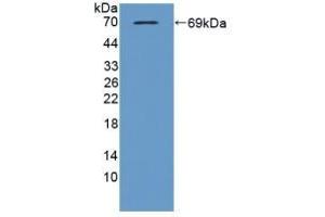 Detection of Recombinant TBP2, Mouse using Polyclonal Antibody to Thioredoxin-interacting Protein (TXNIP) (TXNIP 抗体  (AA 30-381))