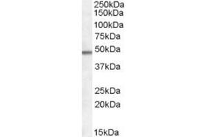 Western Blotting (WB) image for anti-Family with Sequence Similarity 188, Member B (FAM188B) (N-Term) antibody (ABIN2156837) (FAM188B 抗体  (N-Term))