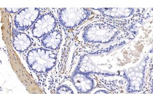 Immunohistochemistry (IHC) image for anti-Actin, Alpha, Cardiac Muscle 1 (ACTC1) (AA 156-368) antibody (ABIN7428392)