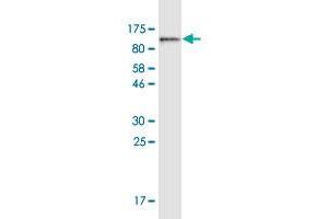 Western Blot detection against GST-pstS1-HSPA5 (98.