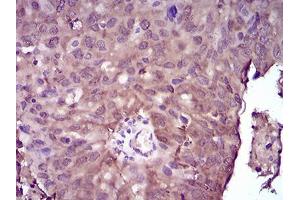 Immunohistochemistry (IHC) image for anti-Nucleoside diphosphate kinase B (NME2) (AA 1-152) antibody (ABIN5542536)