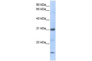 WB Suggested Anti-CXCL16 Antibody Titration:  0. (CXCL16 抗体  (C-Term))