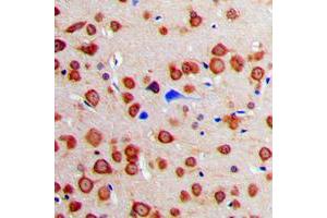Immunohistochemical analysis of Calmodulin staining in human brain formalin fixed paraffin embedded tissue section. (Calmodulin 1 抗体  (Center))