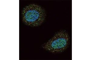 Confocal immunofluorescent analysis of PTEN antibody with MCF-7 cells followed by Alexa Fluor 488-conjugated goat anti-rabbit lgG (green). (PTEN 抗体  (AA 69-104))