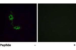 Immunofluorescence analysis of HeLa cells, using GRIA1 polyclonal antibody . (Glutamate Receptor 1 抗体)