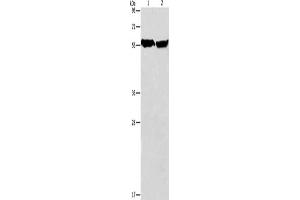 Gel: 8 % SDS-PAGE, Lysate: 40 μg, Lane 1-2: Mouse heart tissue, human fetal brain tissue, Primary antibody: ABIN7128507(ARHGEF9 Antibody) at dilution 1/950, Secondary antibody: Goat anti rabbit IgG at 1/8000 dilution, Exposure time: 5 seconds (Arhgef9 抗体)