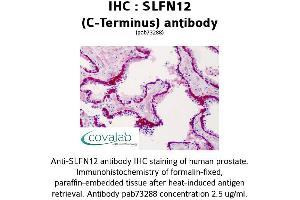 Image no. 1 for anti-Schlafen Family Member 12 (SLFN12) (C-Term) antibody (ABIN1739425) (SLFN12 抗体  (C-Term))