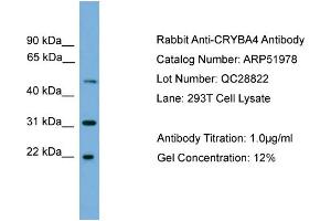 WB Suggested Anti-CRYBA4  Antibody Titration: 0. (CRYbA4 抗体  (Middle Region))