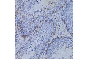 Immunohistochemistry of paraffin-embedded mouse testis using JMJD6 Antibody (ABIN5973452) at dilution of 1/100 (40x lens). (JMJD6 抗体)