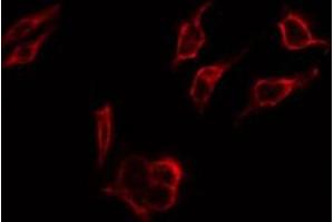 Immunofluorescence (fixed cells) (IF/ICC) image for anti-Estrogen Receptor 1 (ESR1) (pSer167) antibody (ABIN6256169)