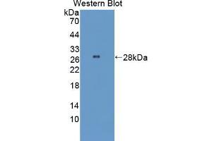Western blot analysis of the recombinant protein. (STING/TMEM173 抗体  (AA 160-371))