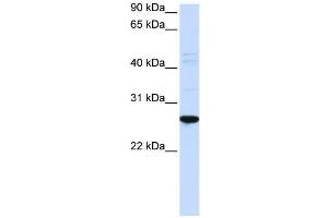 Western Blotting (WB) image for anti-Dorsal Root Ganglia Homeobox (DRGX) antibody (ABIN2459124) (DRGX 抗体)