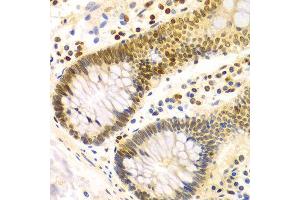 Immunohistochemistry of paraffin-embedded Human colon using DKC1 antibody at dilution of 1:100 (x400 lens). (DKC1 抗体)