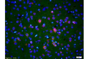 Formalin-fixed and paraffin-embedded rat brain labeled with Anti-Endo G Polyclonal Antibody, Unconjugated (ABIN680893) 1:200, overnight at 4°C, The secondary antibody was Goat Anti-Rabbit IgG, Cy3 conjugated used at 1:200 dilution for 40 minutes at 37°C. (Endonuclease G 抗体  (AA 101-200))